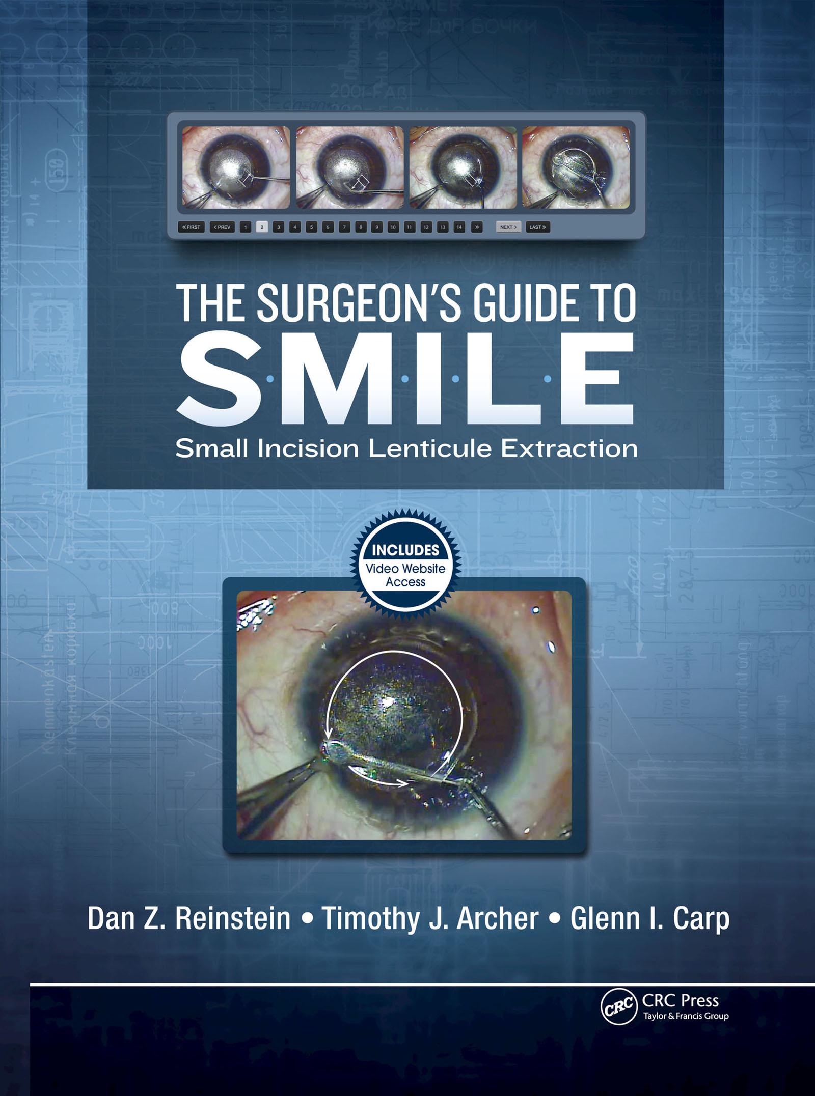 The Surgeon’s Guide to SMILE