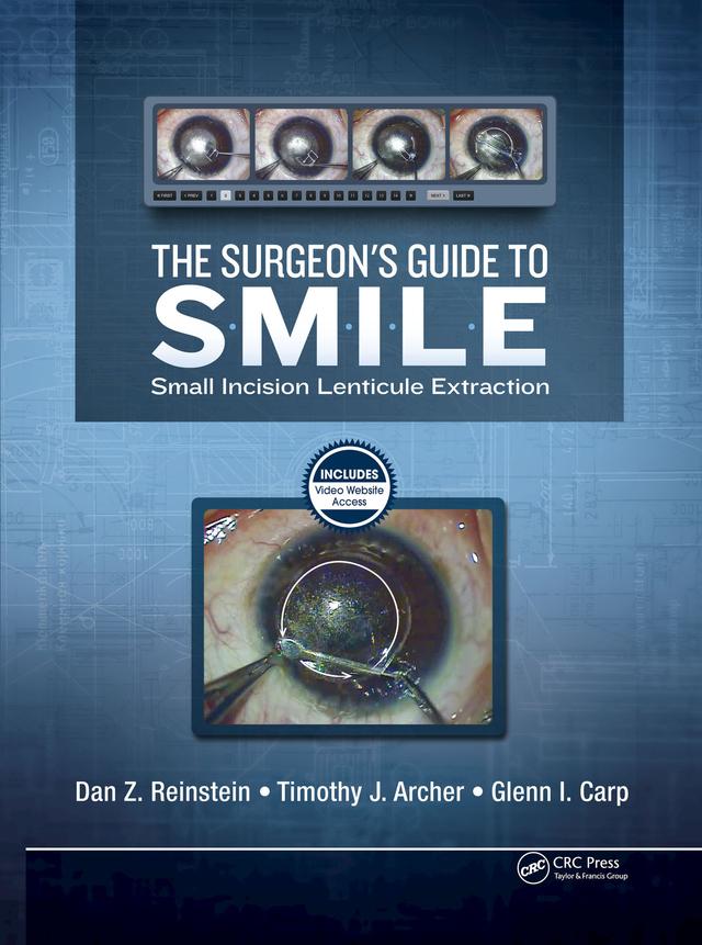The Surgeon’s Guide to SMILE by Dan Reinstein, Glenn Carp, Timothy Archer