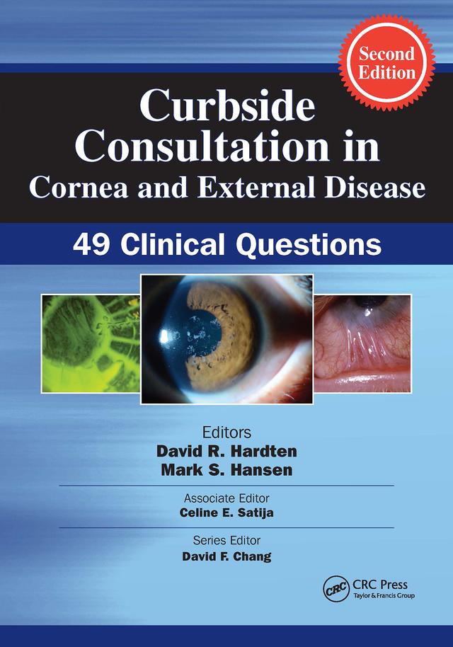 Curbside Consultation in Cornea and External Disease by Celine Satija, David R. Hardten, Mark Hansen