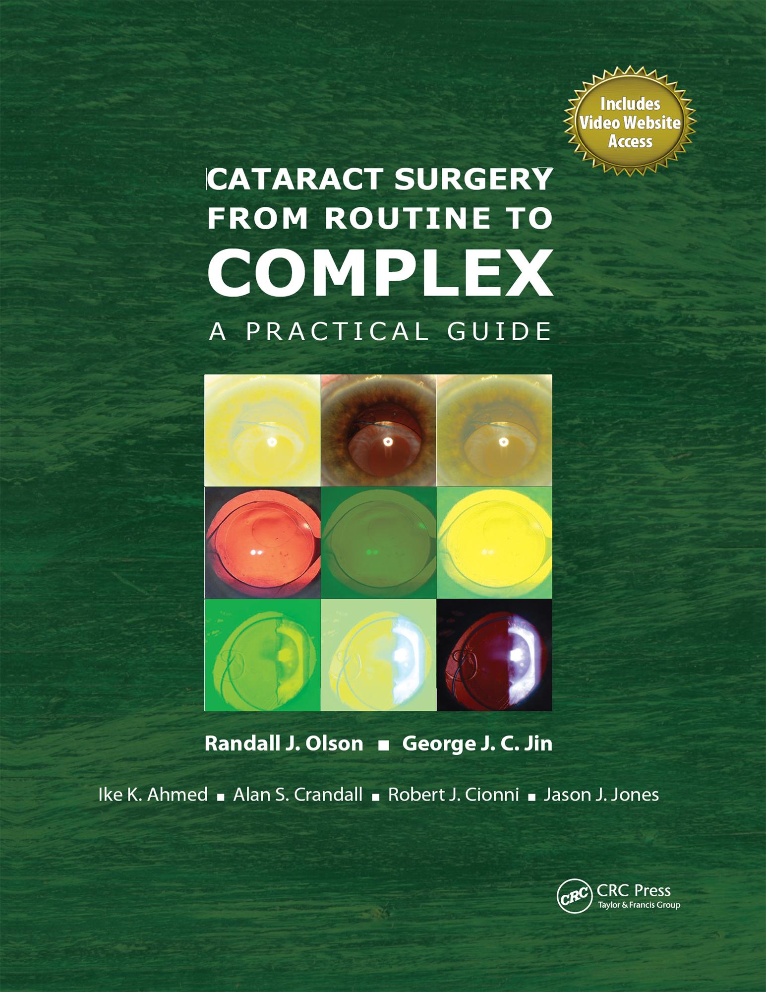 Cataract Surgery from Routine to Complex
