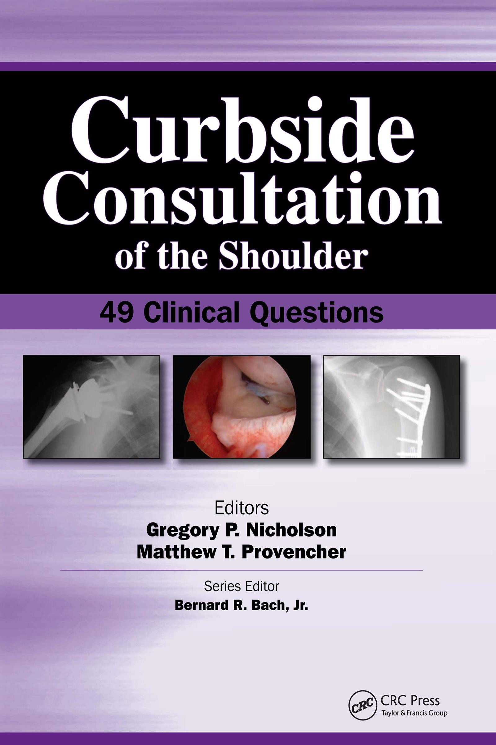 Curbside Consultation of the Shoulder