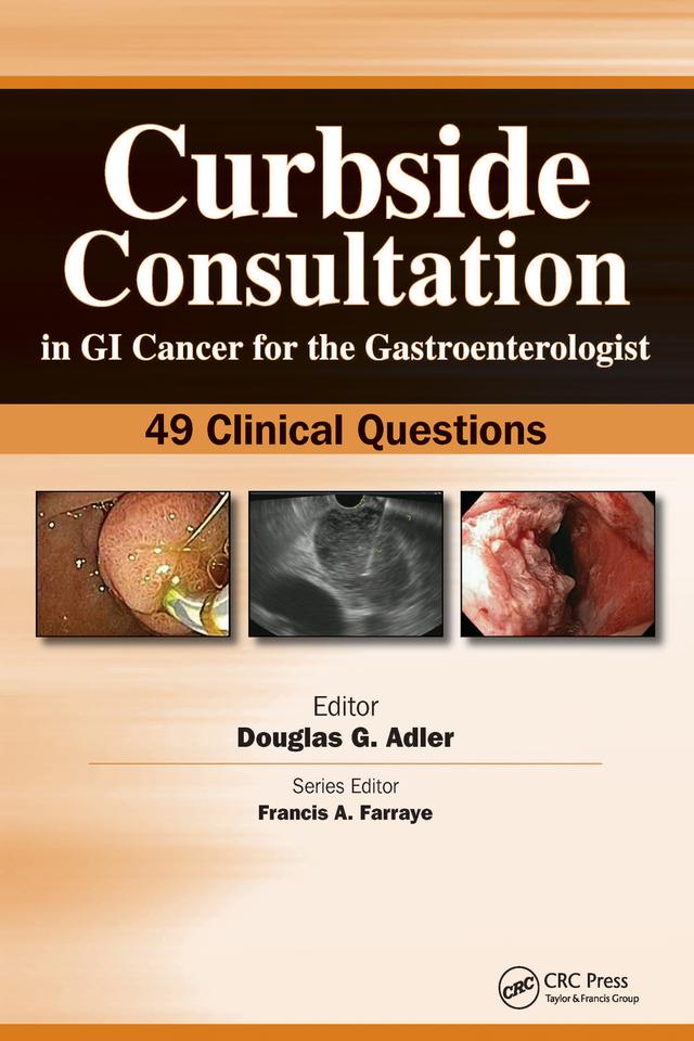 Curbside Consultation in GI Cancer for the Gastroenterologist by Douglas Adler