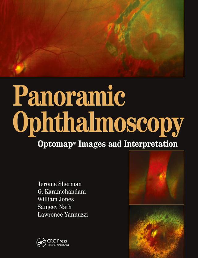 Panoramic Ophthalmoscopy by Gulshan Karamchandani, Jerry Sherman, Sanjeev Nath, William Jones