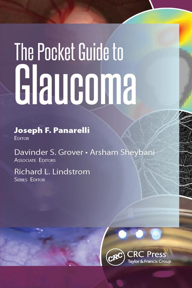 The Pocket Guide to Glaucoma by Arsham Sheybani, Davinder Grover, Joseph Panarelli
