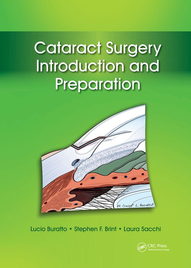 Cataract Surgery by Laura Sacchi, Lucio Buratto, Stephen Brint