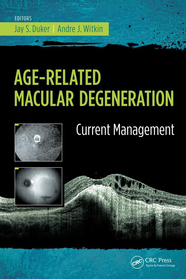 Age-Related Macular Degeneration by Andre Witkin, Jay Duker