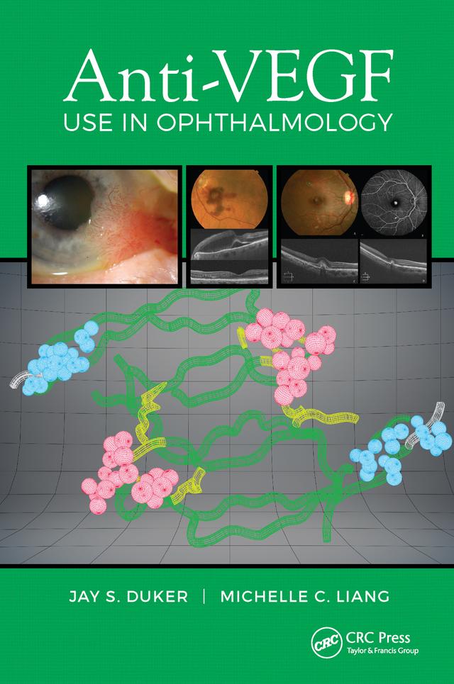 Anti-VEGF Use in Ophthalmology by Jay Duker, Michelle Liang