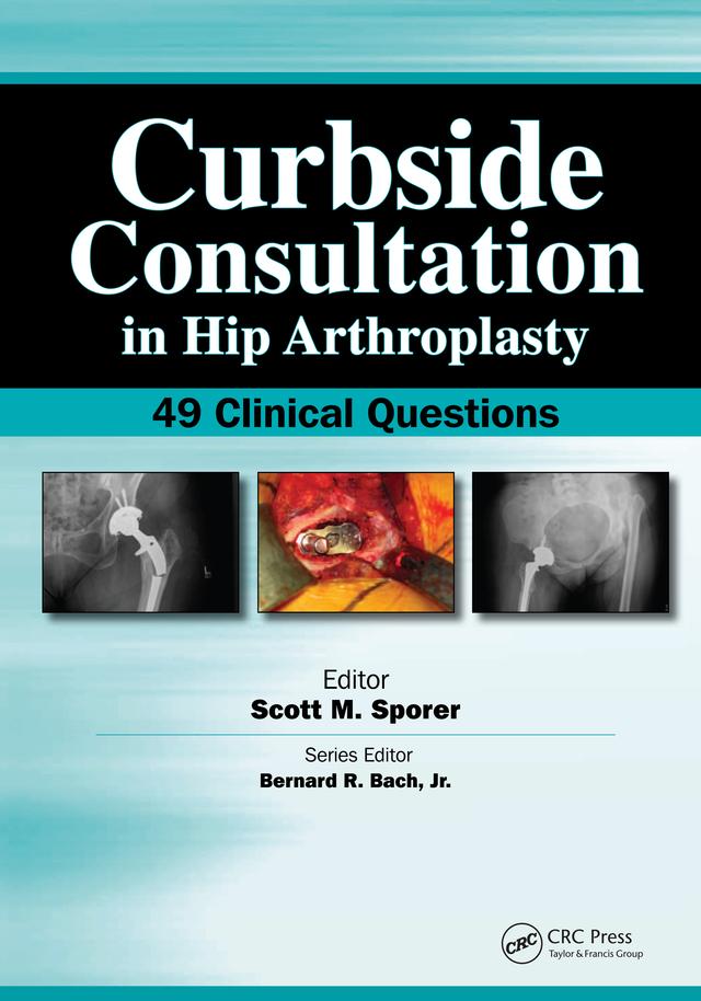 Curbside Consultation in Hip Arthroplasty by Scott Sporer