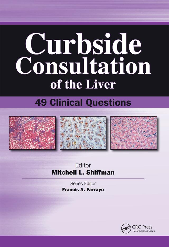 Curbside Consultation of the Liver by Mitchell Shiffman