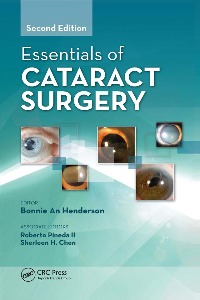 Essentials of Cataract Surgery by Bonnie Henderson