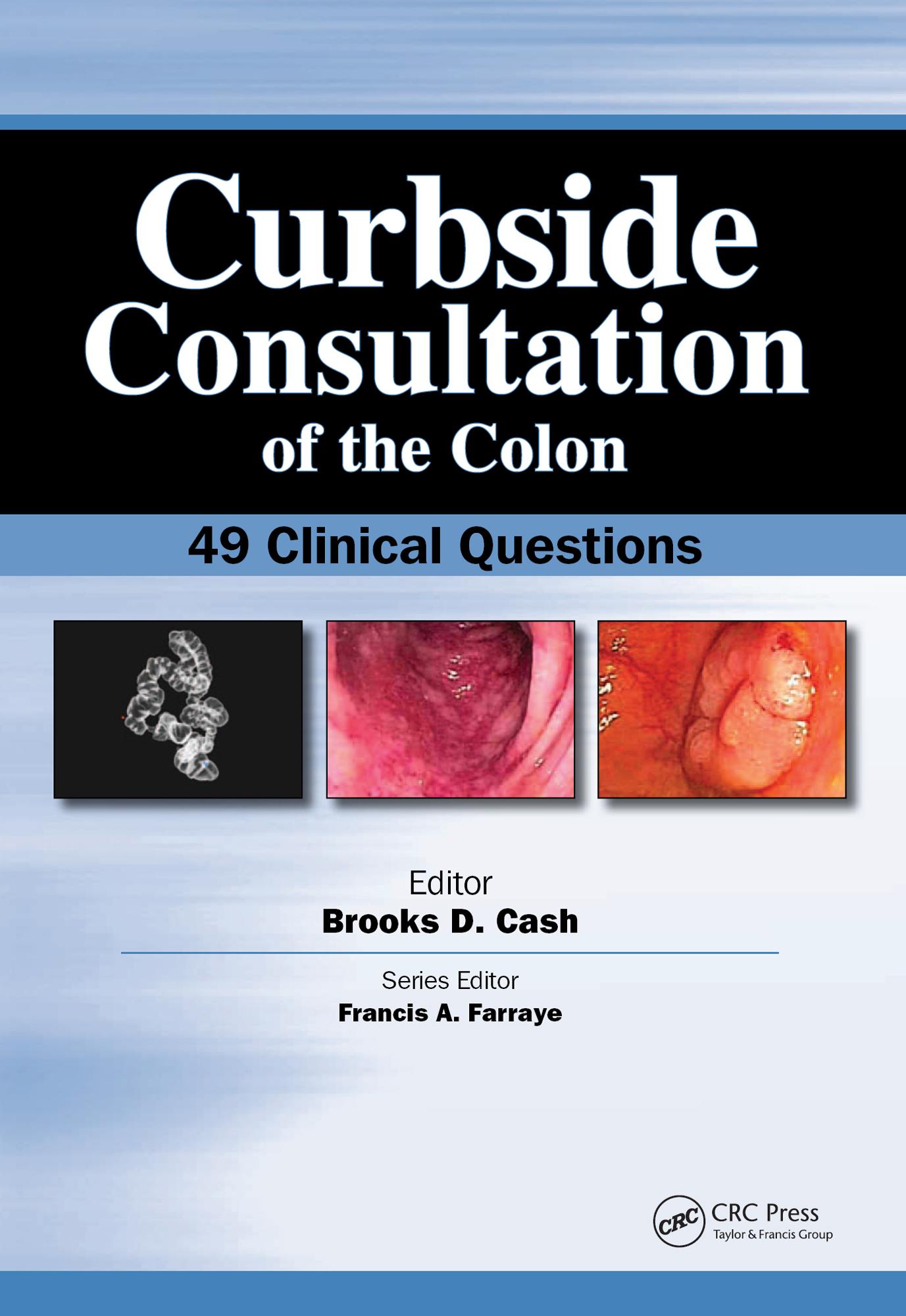 Curbside Consultation of the Colon