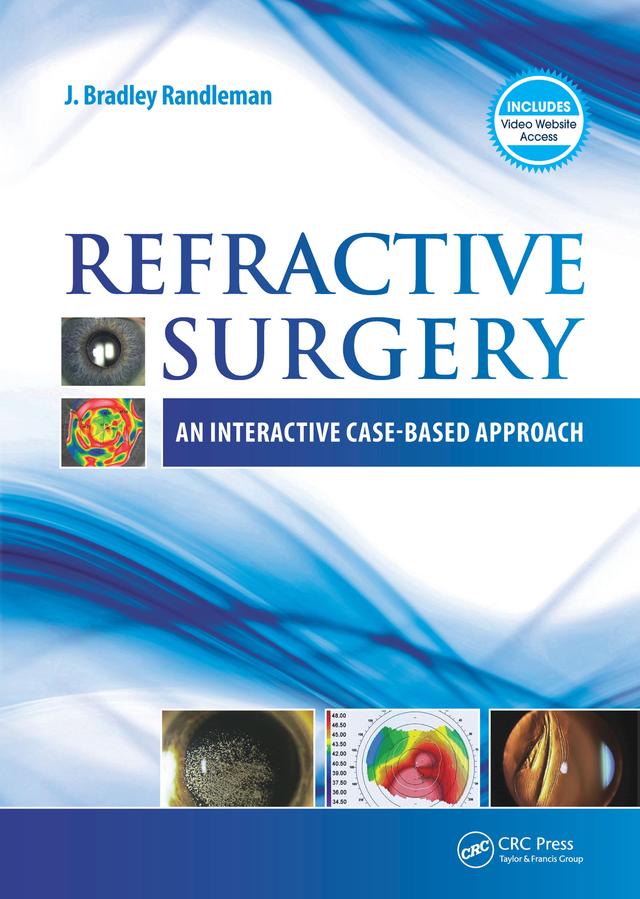 Refractive Surgery by J. Bradley Randleman