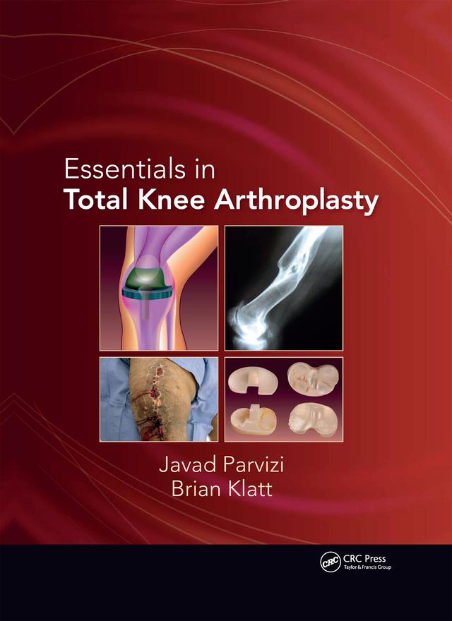 Essentials in Total Knee Arthroplasty by Brian Klatt, Javad Parvizi