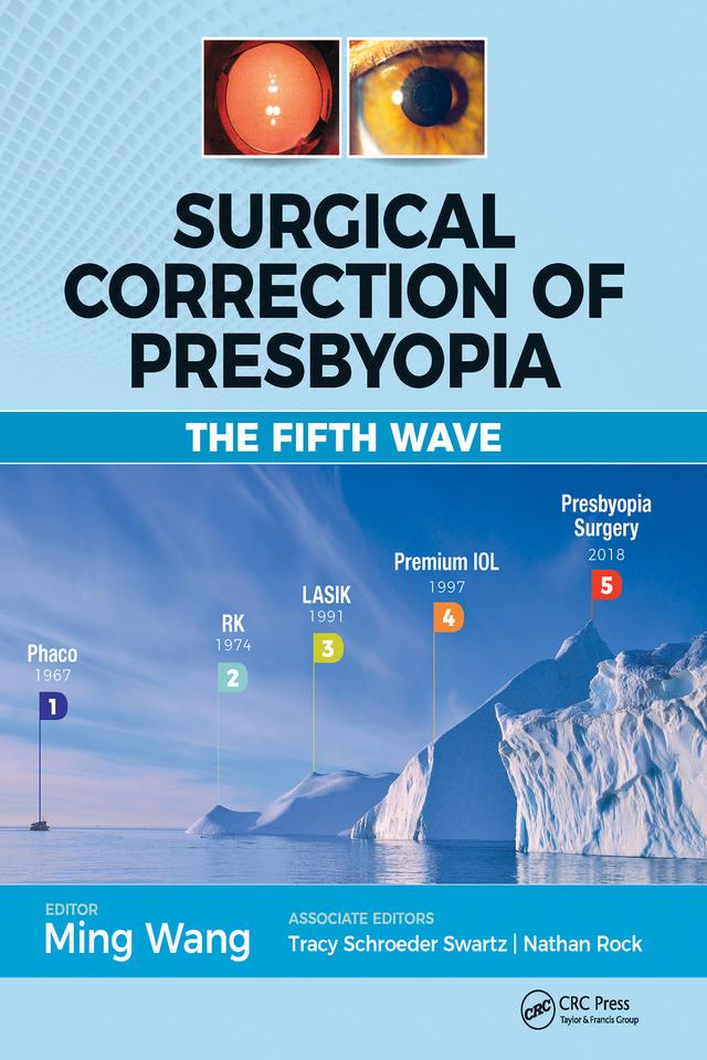 Surgical Correction of Presbyopia by Ming Wang