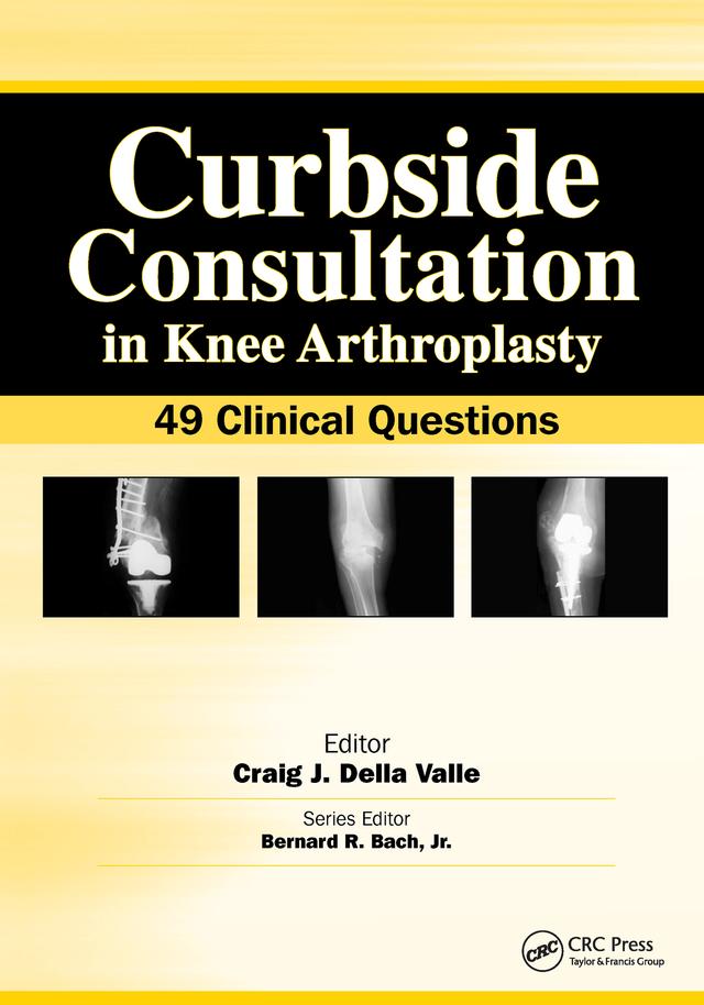 Curbside Consultation in Knee Arthroplasty by Craig Della Valle