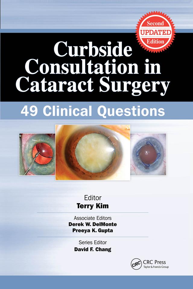 Curbside Consultation in Cataract Surgery by Terry Kim