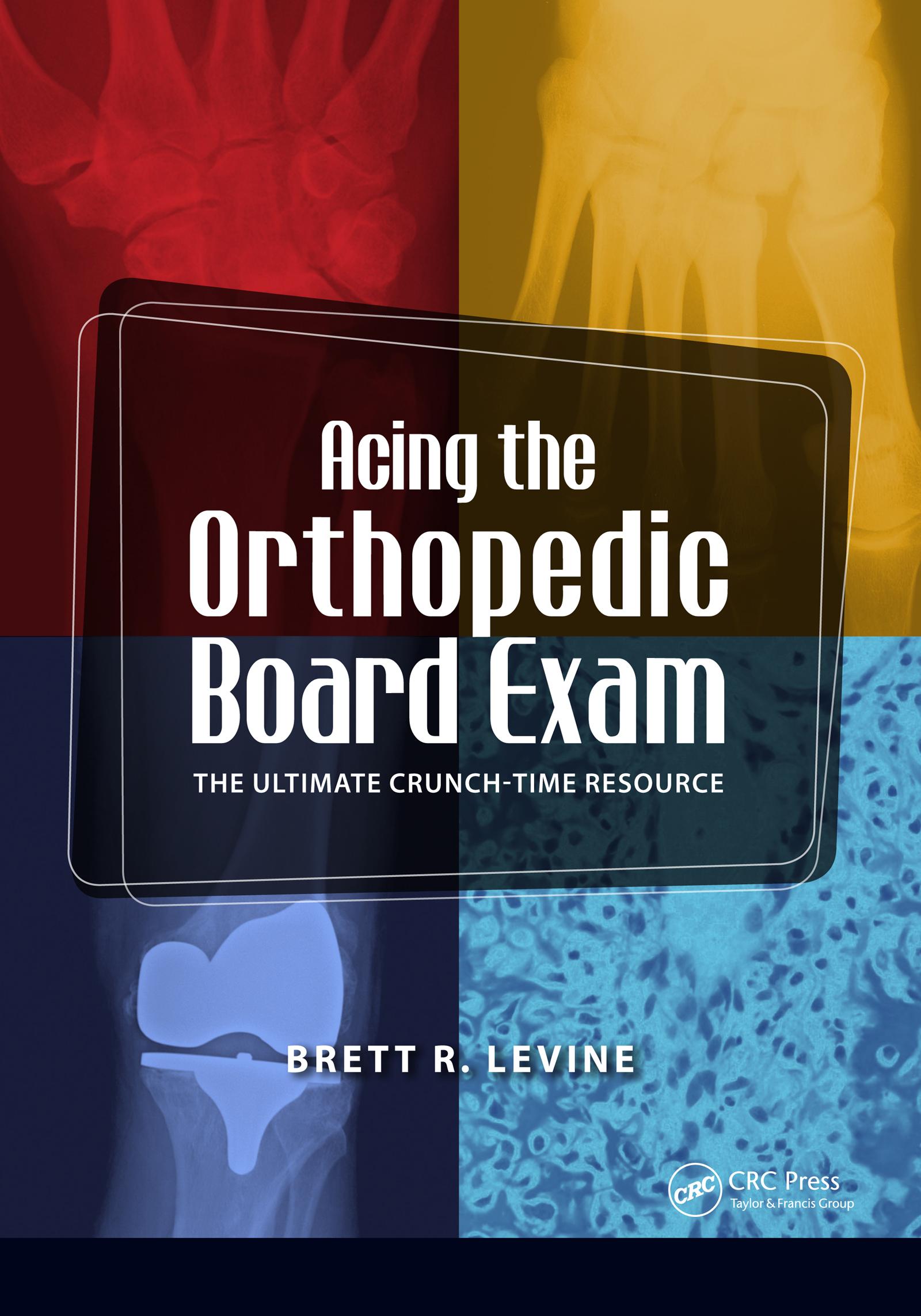 Acing the Orthopedic Board Exam