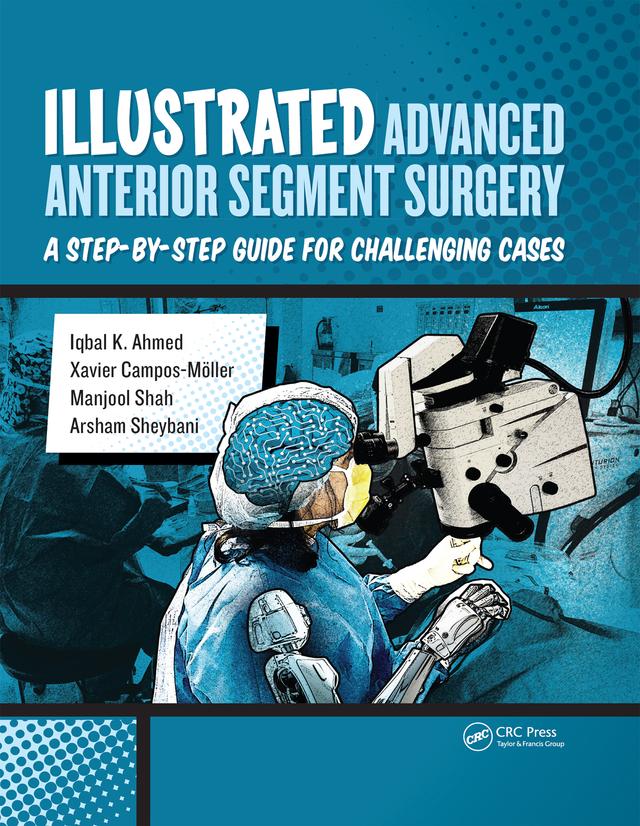 Illustrated Advanced Anterior Segment Surgery by Arsham Sheybani, Iqbal Ahmed, Manjool Shah, Xavier Möller