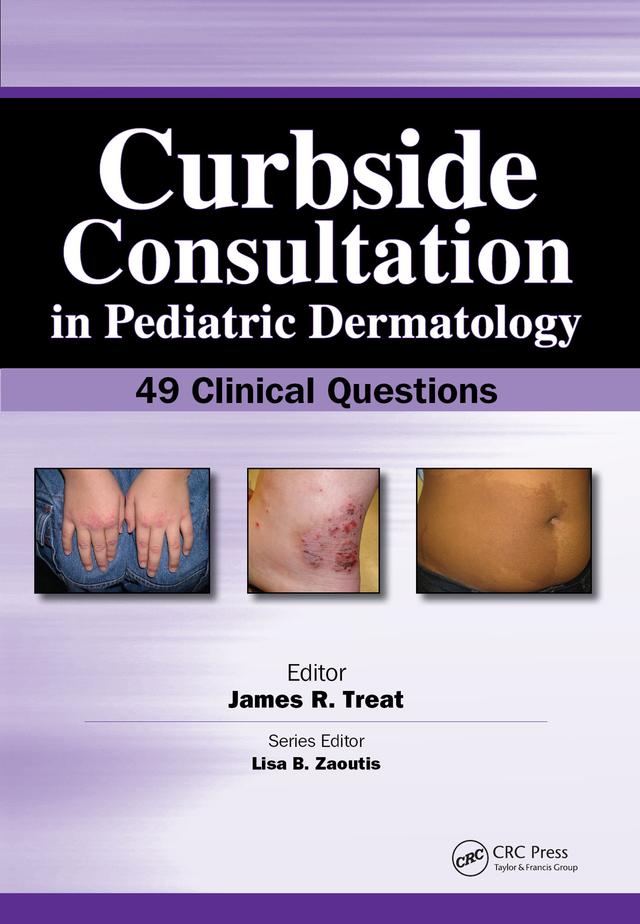 Curbside Consultation in Pediatric Dermatology by James Treat