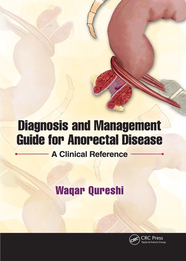 Diagnosis and Management Guide for Anorectal Disease by Waqar Qureshi