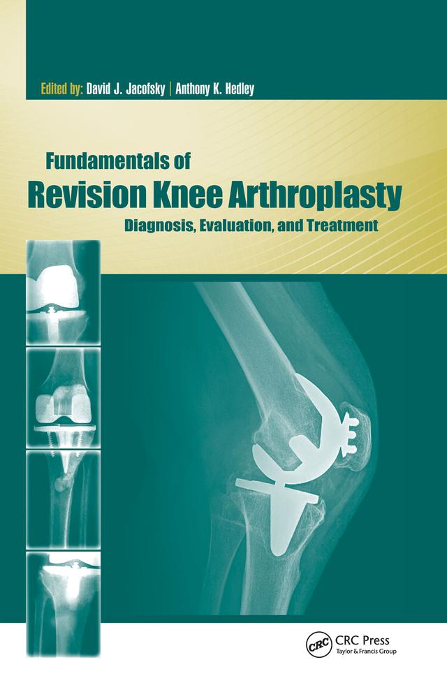 Fundamentals of Revision Knee Arthroplasty by Anthony Hedley, David Jacofsky