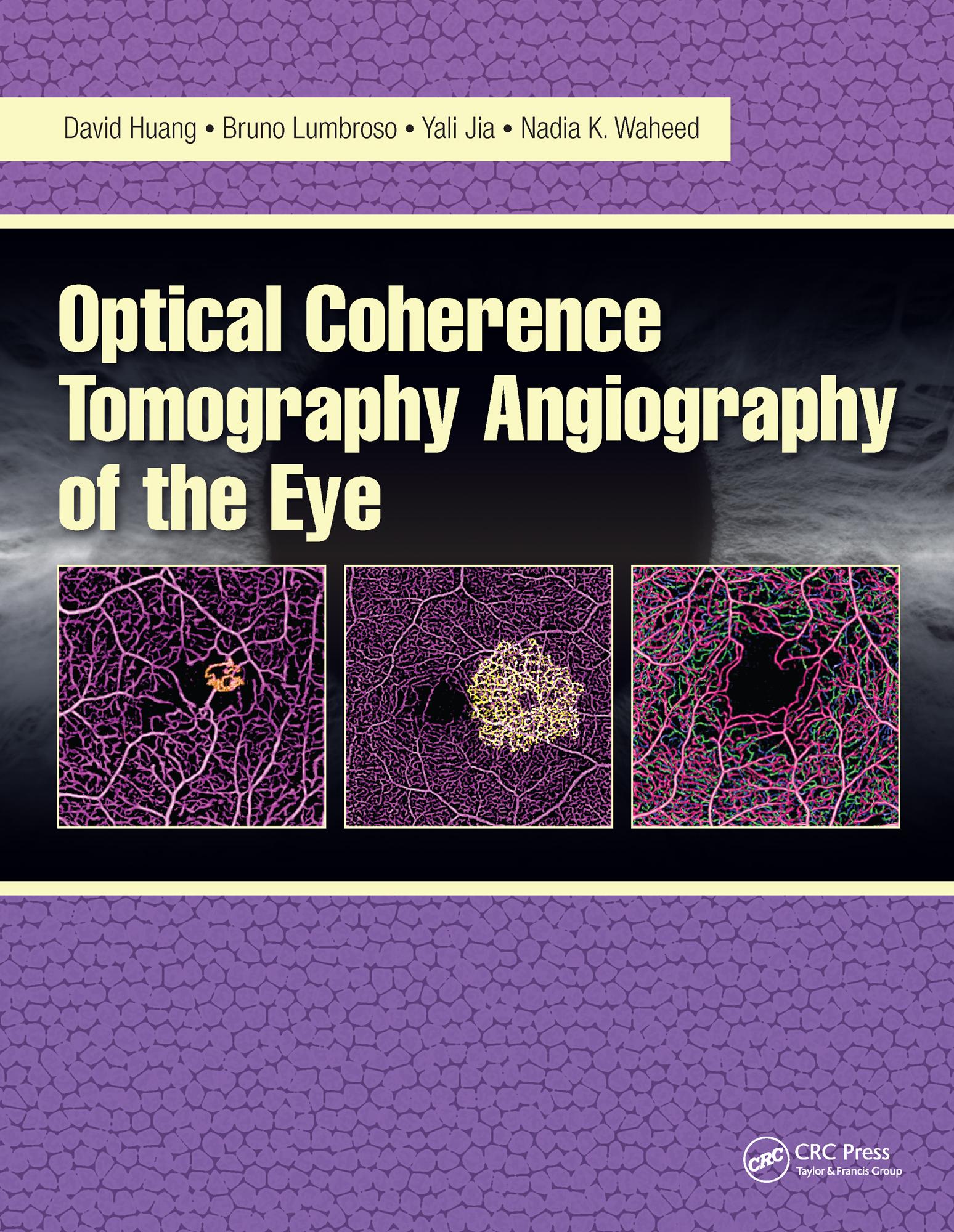 Optical Coherence Tomography Angiography of the Eye