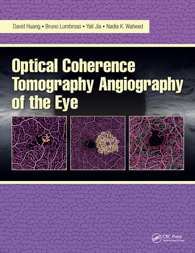Optical Coherence Tomography Angiography of the Eye by Bruno Lumbroso, David Huang, Nadia Waheed, Yali Jia