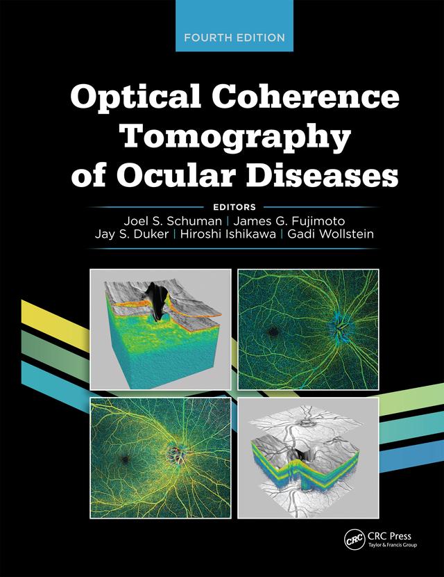 Optical Coherence Tomography of Ocular Diseases by Hiroshi Ishikawa, James G. Fujimoto, Jay Duker, Joel S. Schuman
