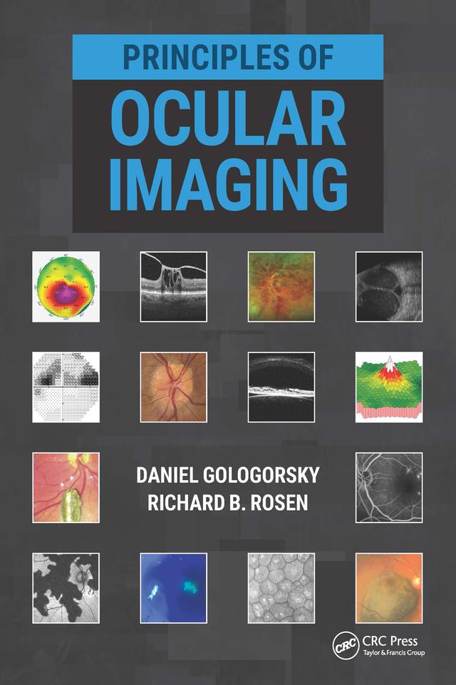 Principles of Ocular Imaging by Daniel Gologorsky, Richard Rosen