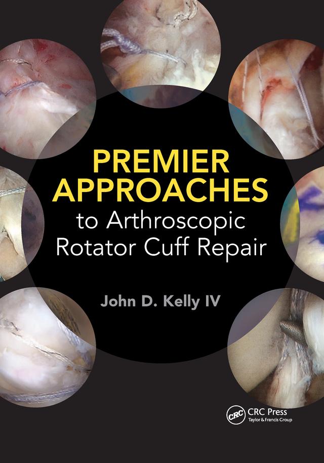 Premier Approaches to Arthroscopic Rotator Cuff Repair by John Kelly