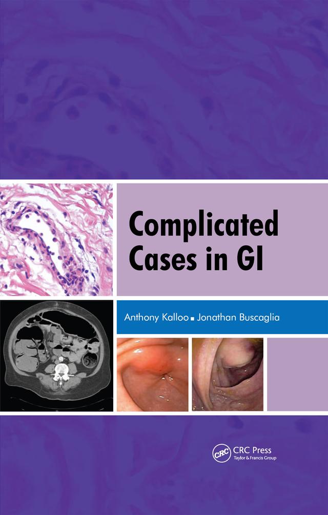 Complicated Cases in GI by Anthony Kalloo