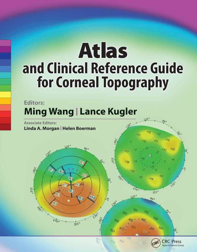 Atlas and Clinical Reference Guide for Corneal Topography by Lance Kugler, Ming Wang