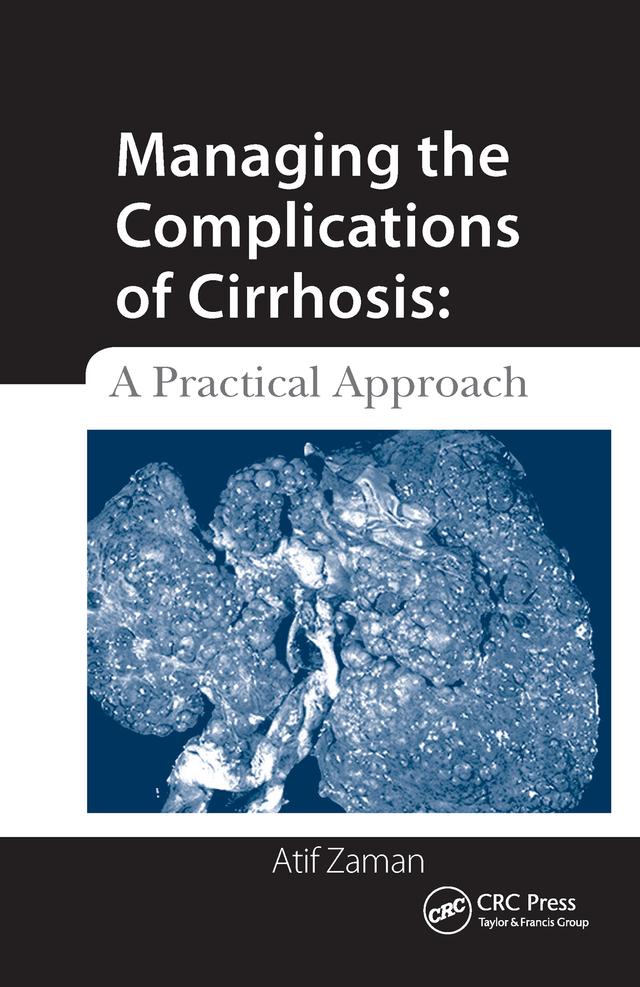 Managing the Complications of Cirrhosis by Atif Zaman