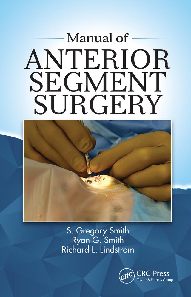 Manual of Anterior Segment Surgery by Richard Lindstrom, Ryan Smith, S Gregory Smith