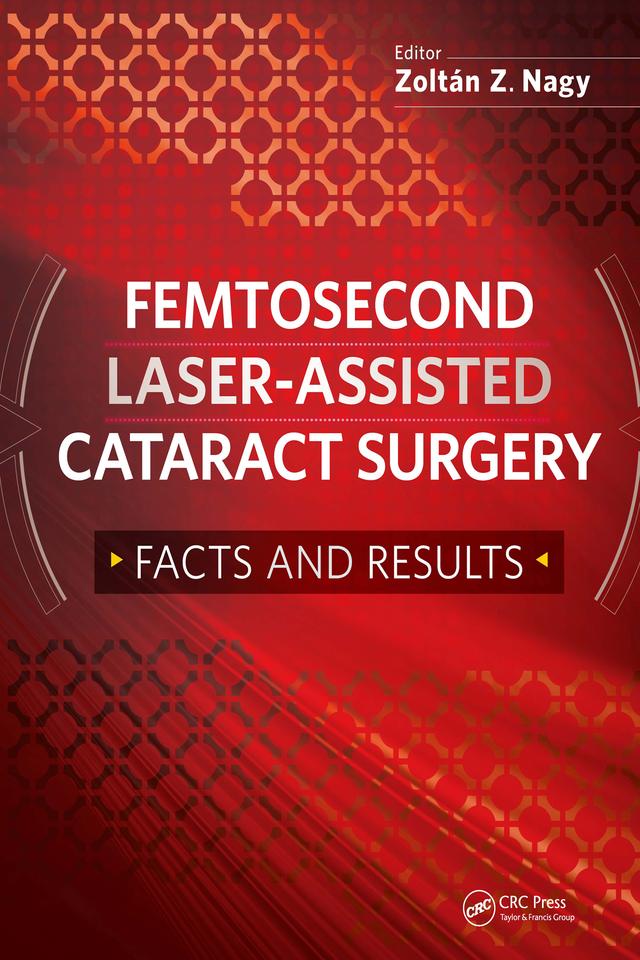 Femtosecond Laser-Assisted Cataract Surgery by Zoltan Nagy