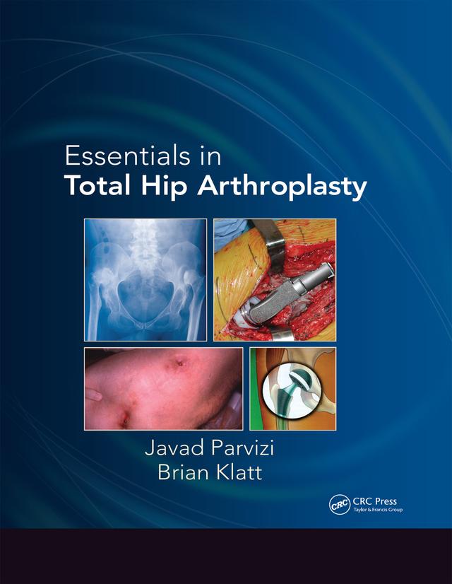Essentials in Total Hip Arthroplasty by Brian Klatt, Javad Parvizi