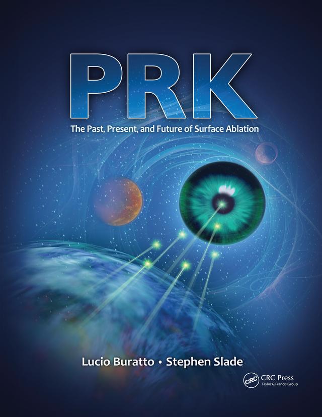 PRK by Lucio Buratto, Stephen Slade