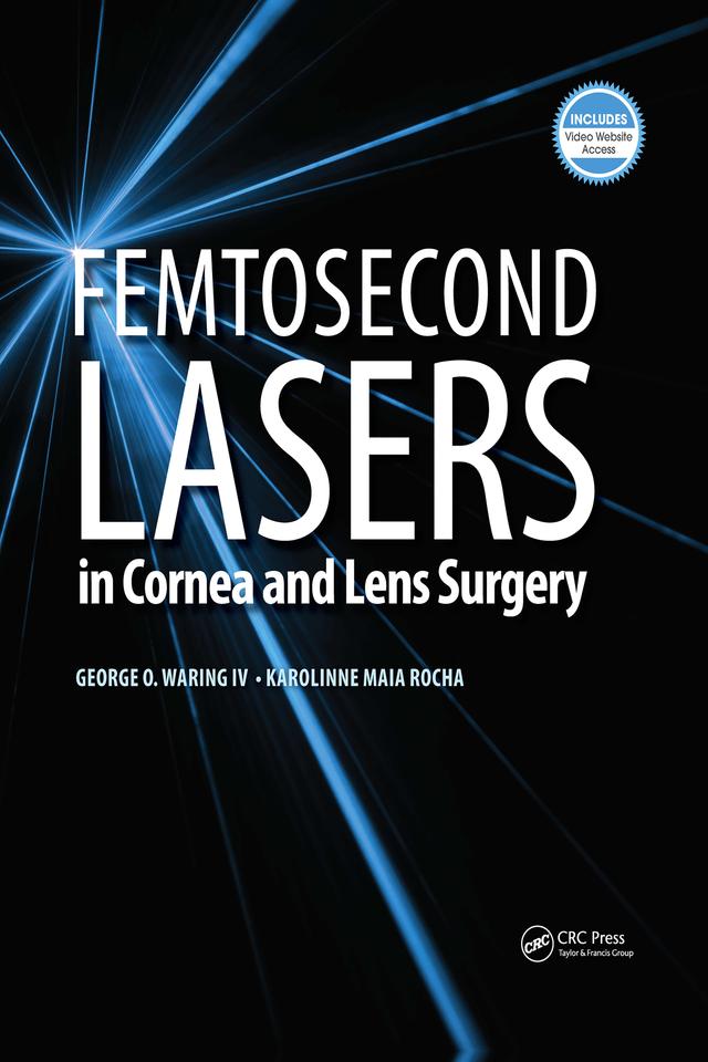 Femtosecond Lasers in Cornea and Lens Surgery by George Waring, Karolinne Rocha