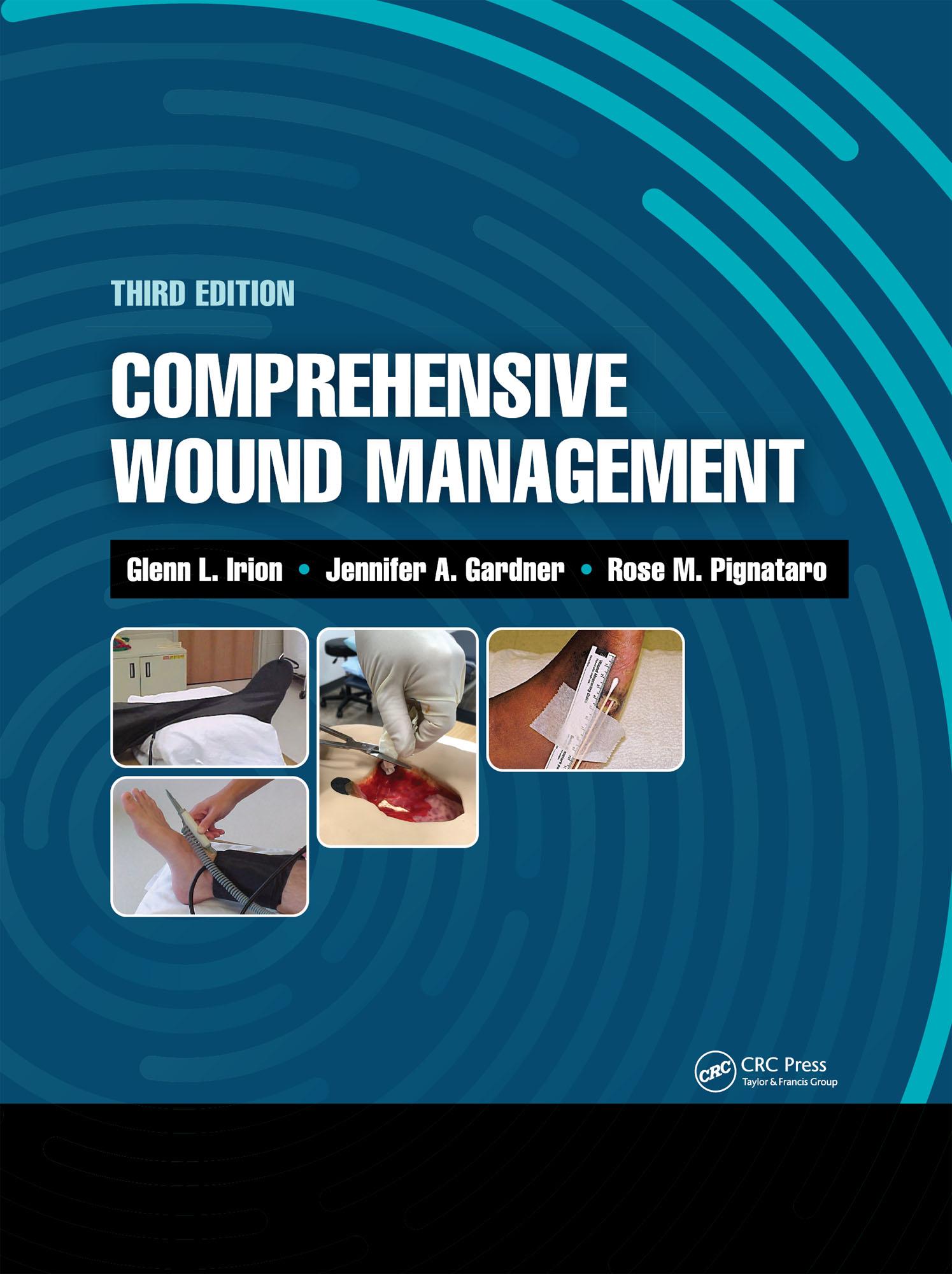 Comprehensive Wound Management