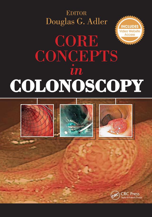 Core Concepts in Colonoscopy by Douglas Adler