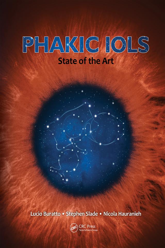 Phakic IOLs by Lucio Buratto, Nicola Hauranieh, Stephen Slade
