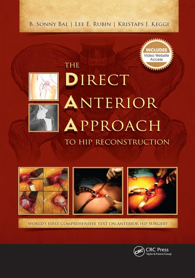 The Direct Anterior Approach to Hip Reconstruction by B. Bal, Kristaps Keggi, Lee Rubin