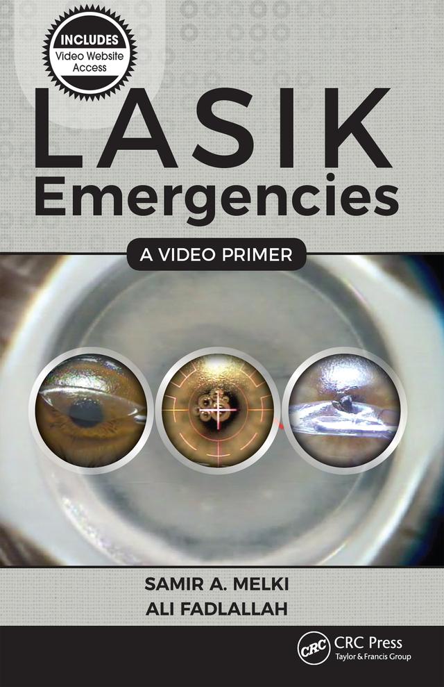 LASIK Emergencies: A Video Primer by Ali Fadlallah, Samir A. Melki