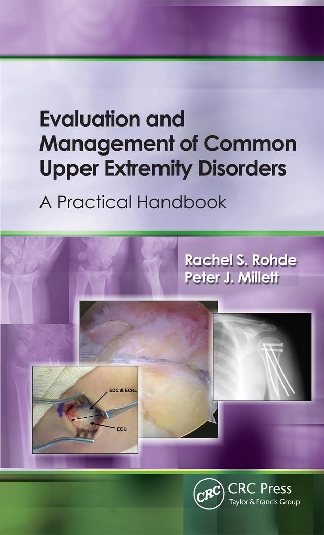 Evaluation and Management of Common Upper Extremity Disorders by Peter Millett, Rachel Rohde