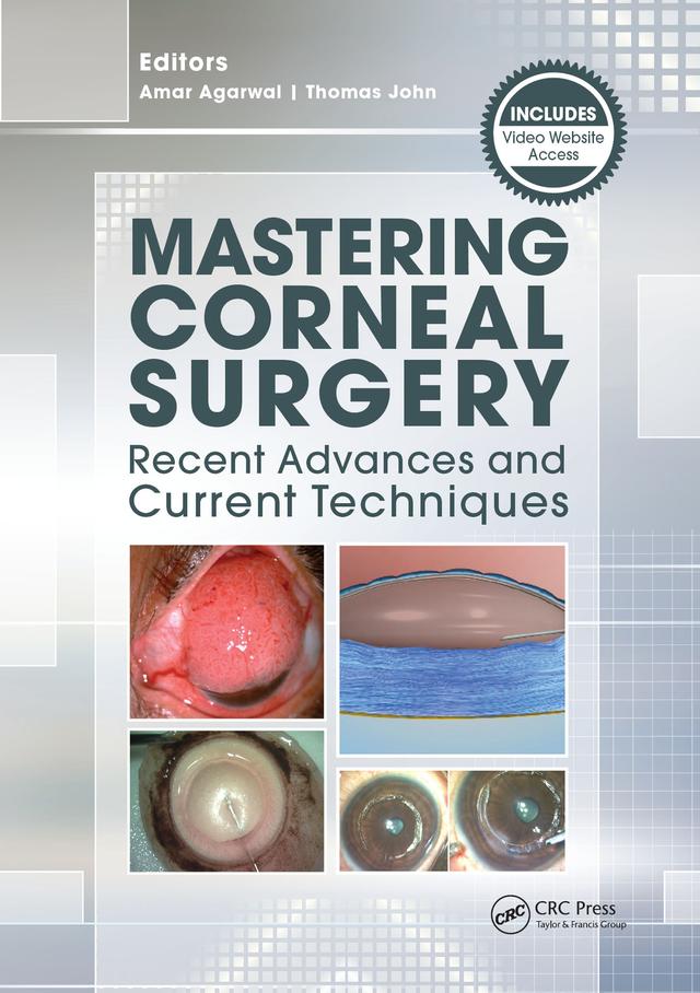 Mastering Corneal Surgery by Amar Agarwal, Thomas John