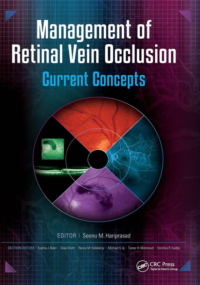 Management of Retinal Vein Occlusion by Seenu Hariprasad