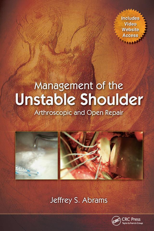 Management of the Unstable Shoulder by Jeffrey Abrams