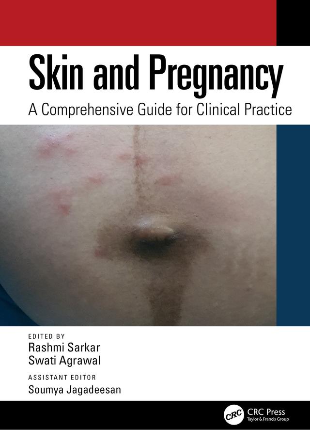 Skin and Pregnancy by Rashmi Sarkar, Soumya Jagadeesan, Swati Agrawal