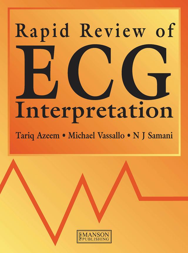 Rapid Review of ECG Interpretation by Michael Vassallo, Nilesh Samani, Tariq Azeem