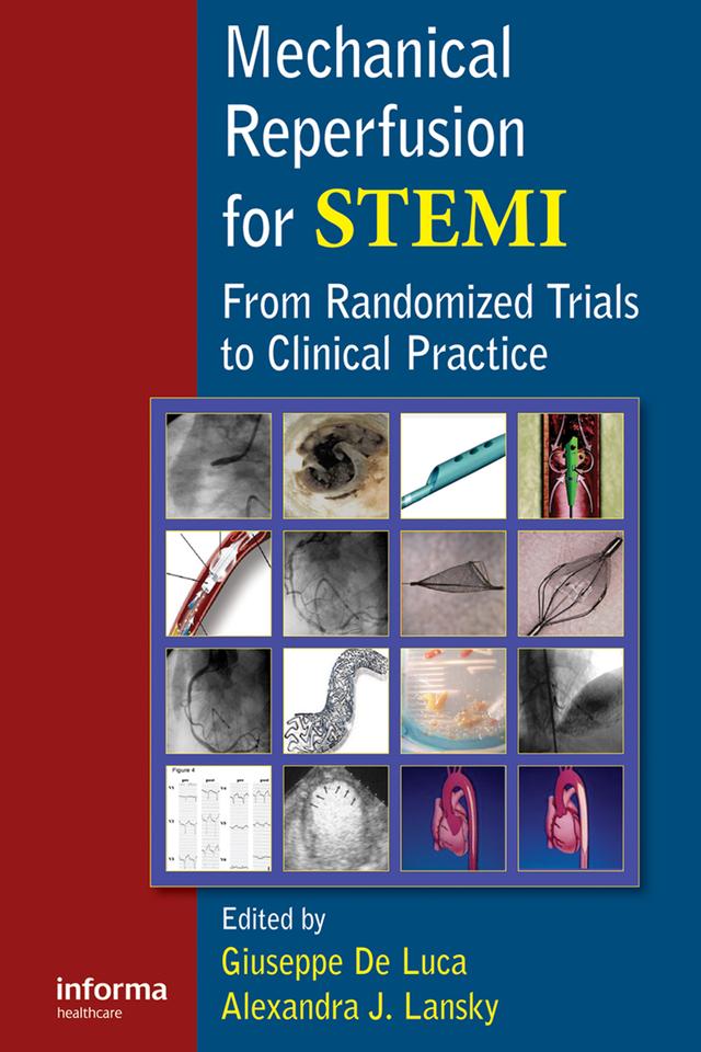 Mechanical Reperfusion for STEMI by Alexandra Lansky, Giuseppe De Luca